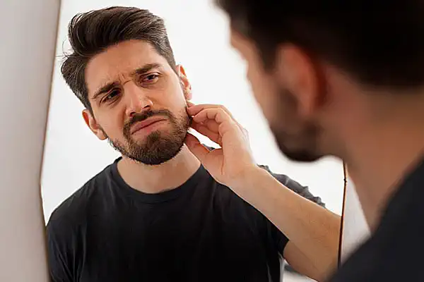 Who is a Good Candidate for Beard Transplant?